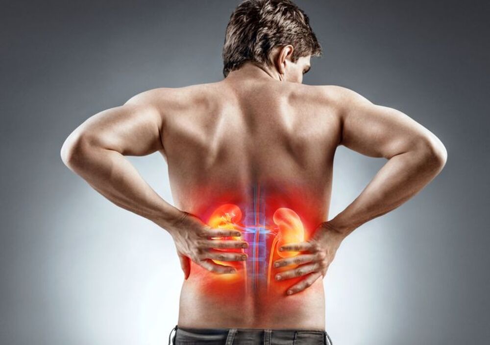 Can Coffee Cause Kidney Stones? Debunking the Myths with Science and Specialty Coffee Insights